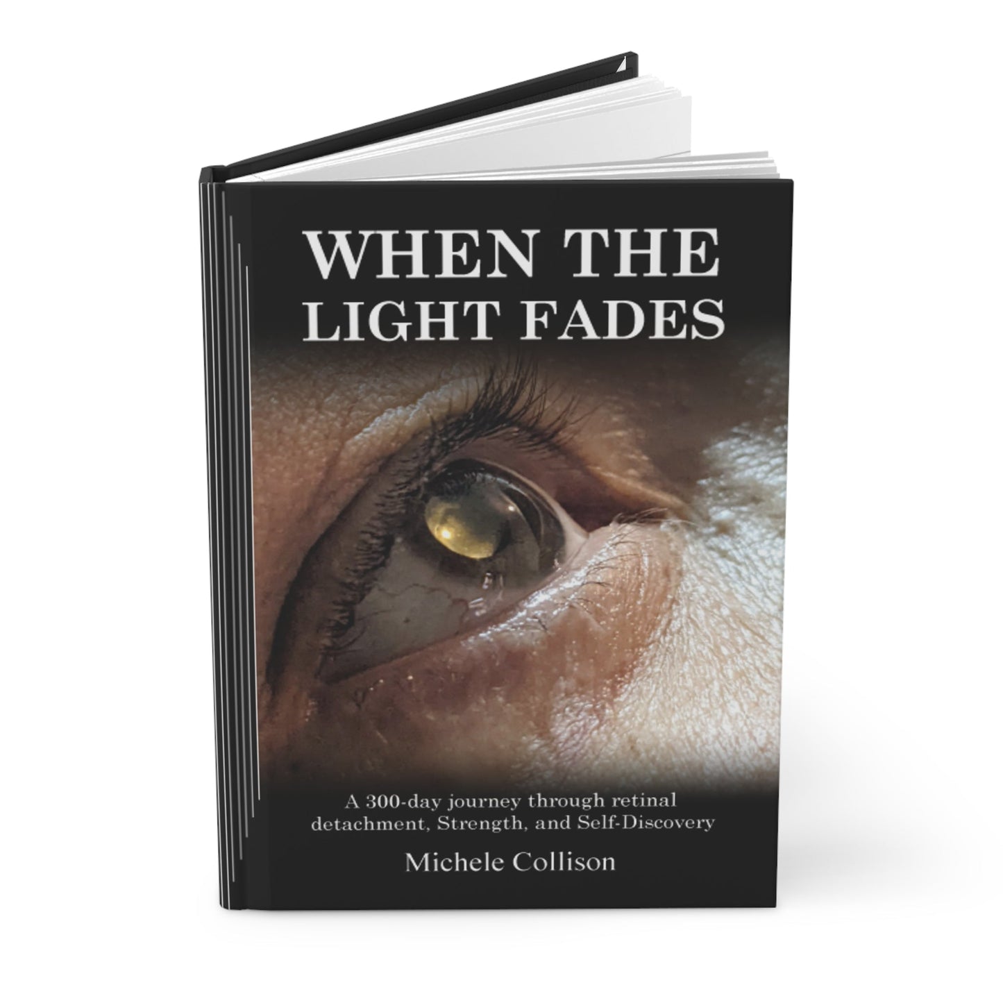 When The Light Fades A 300-day journey through retinal